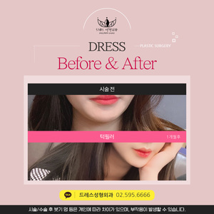턱필러