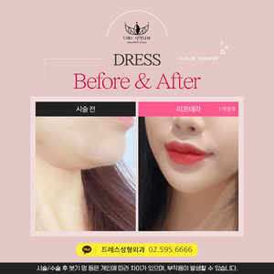 리프테라