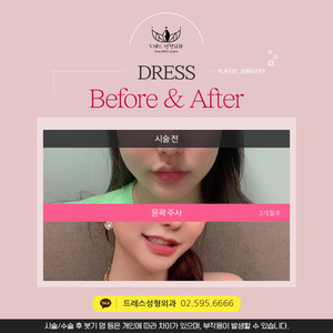 윤곽주사