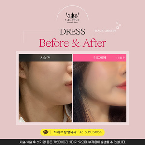 리프테라