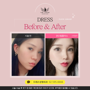 큐오필플러스
