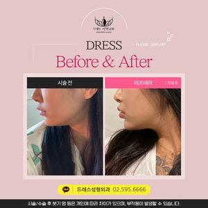 리프테라