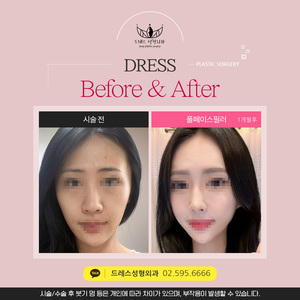 풀페이스필러
