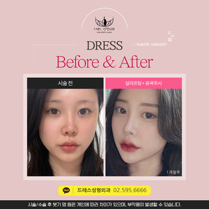 실리프팅 + 윤곽주사