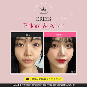 입술필러