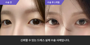 자연유착 + 윗트임