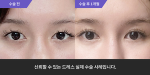 자연유착