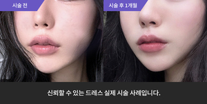 스킨바이브