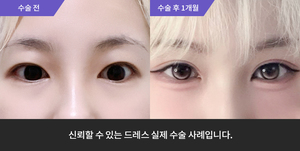 자연유착 + 윗트임