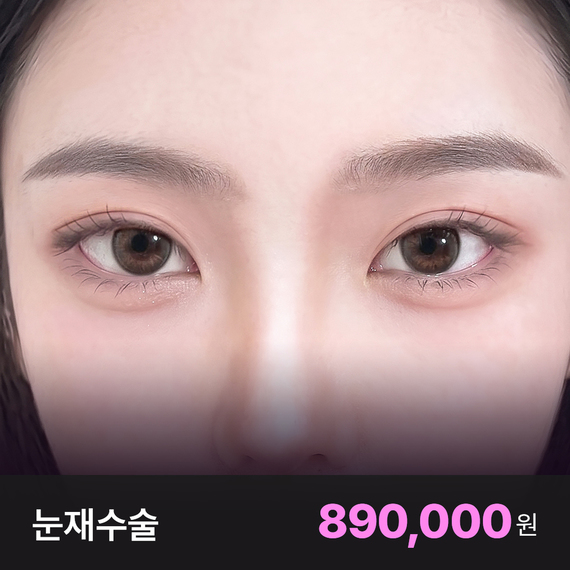 드레스 눈재수술
